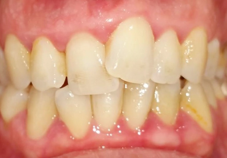 caso ortodonzia - prima