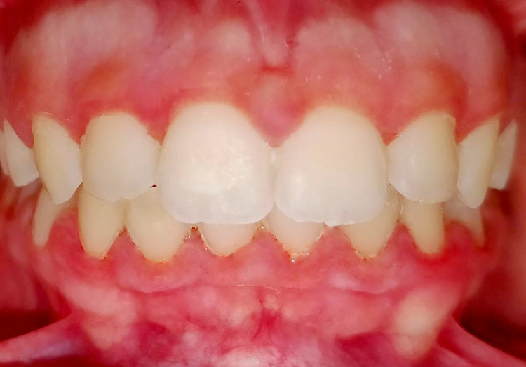 caso ortodonzia - dopo
